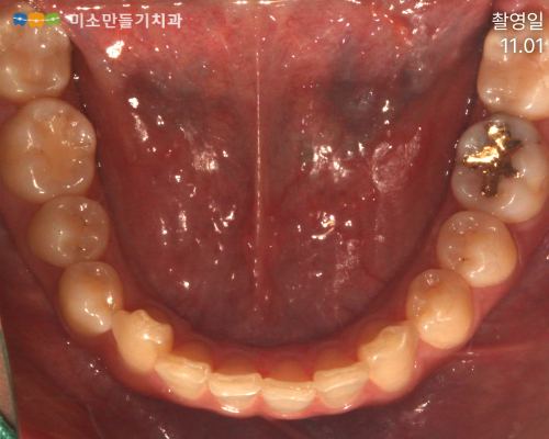 실제 사례로 보는 진행 과정 관련 사진 1