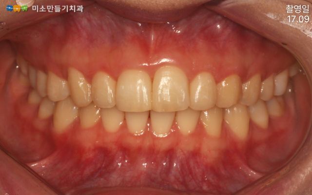 실제 사례로 보는 진행 과정 관련 사진 3