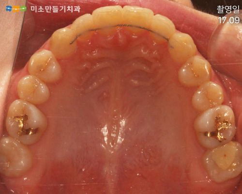 유지관리가 특히 중요한 이유 관련 사진 2