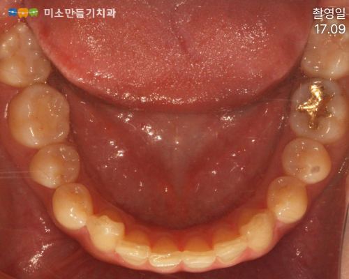 유지관리가 특히 중요한 이유 관련 사진 3