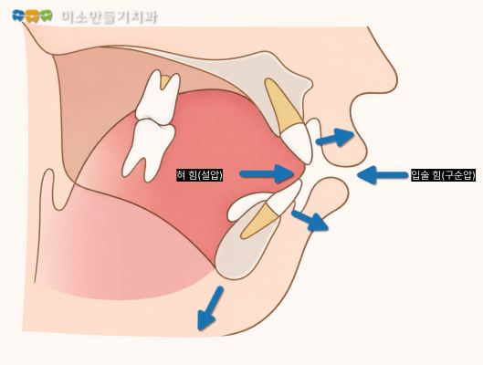 혀 내밀기