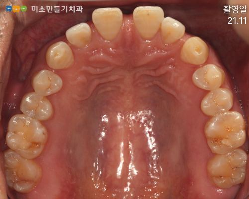 공간을 닫는 것만으로 끝나지 않는 이유 관련 사진 3