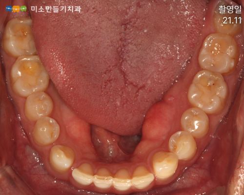 실제 개선 사례 관련 사진 1