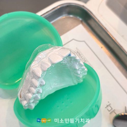 장치 세척, 언제 얼마나 해야 할까요 관련 사진