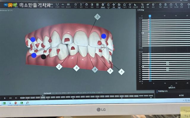 실패 위험을 줄이는 2가지 확인 포인트 관련 사진