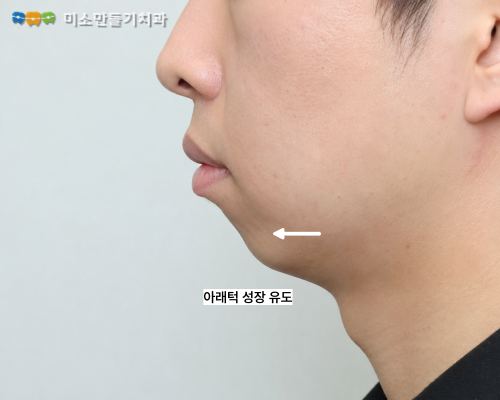 MA 기능이란 관련 사진