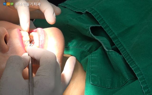 착용 시간이 중요한 이유 관련 사진 2