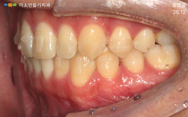 진행 과정과 변화 관련 사진 3