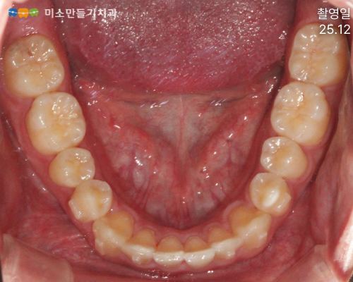 진행 과정과 변화 관련 사진 5